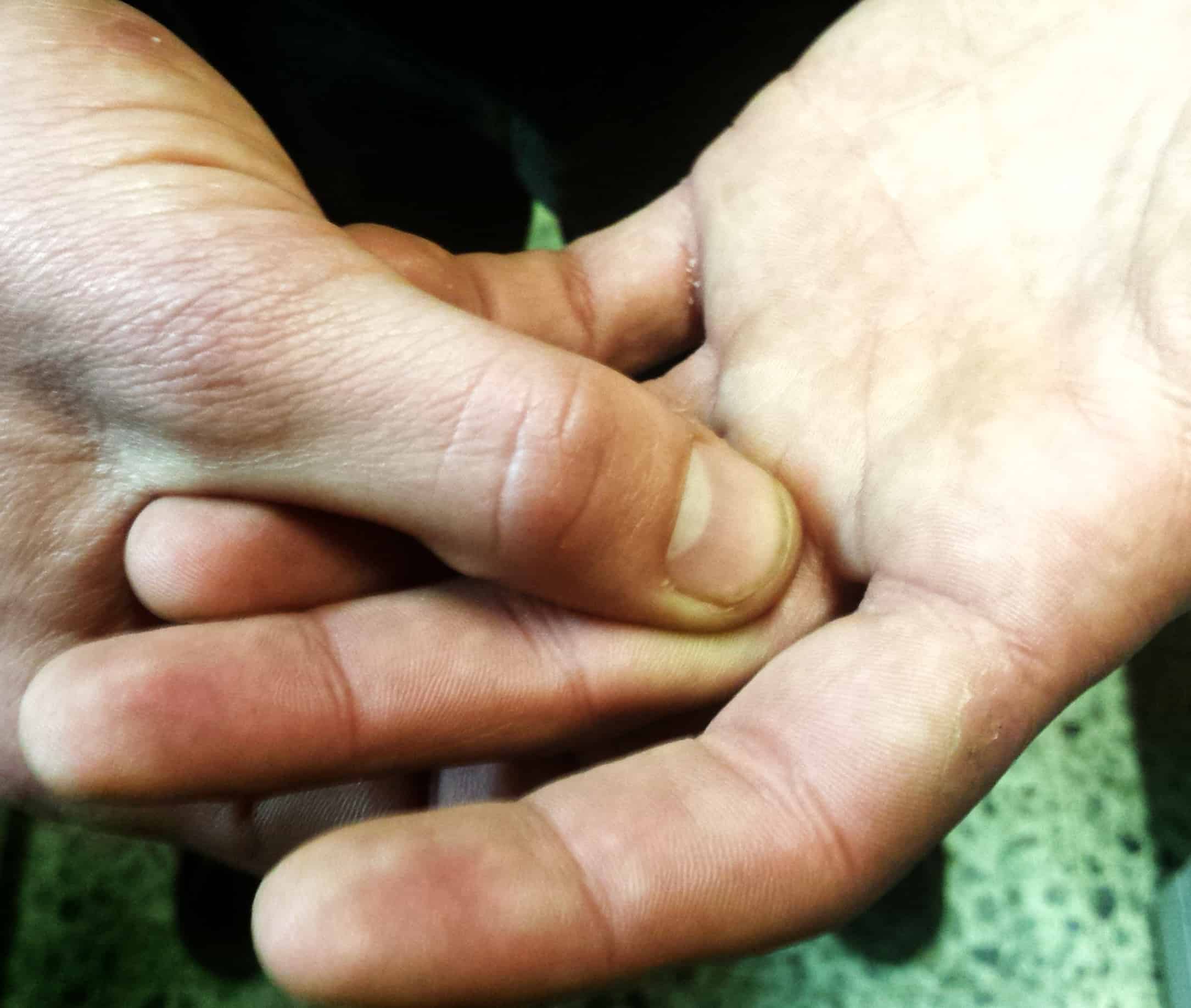 4. palpació ant. F1